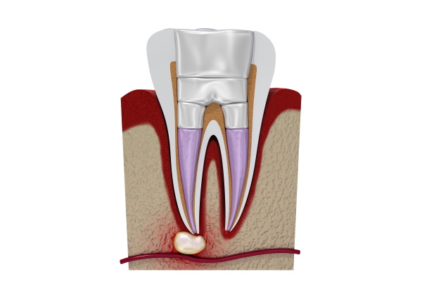A12230925]写真とエビデンスで歯種別に学ぶ! 歯内療法に生かす根管解剖